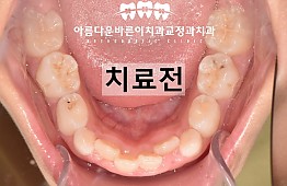 수술전
