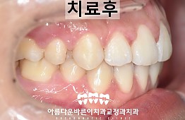 수술후