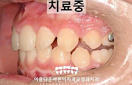수술후