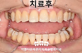 수술후