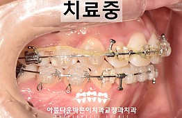 수술후