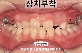 수술후