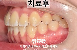 수술후