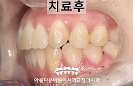 수술후