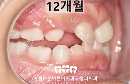 수술후