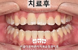 수술후
