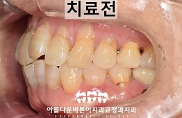 수술전