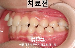 수술전