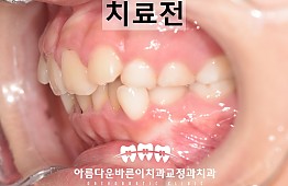수술전