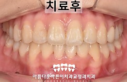 수술후