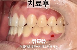 수술후