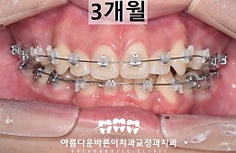 수술후