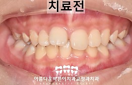 수술전
