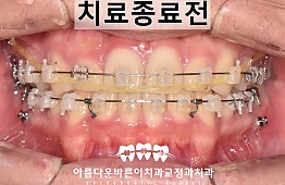 수술후