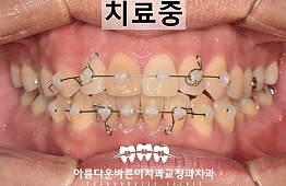 수술후