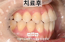 수술후
