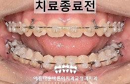 수술후