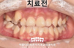 수술전