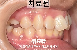 수술전