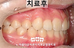 수술후