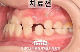 수술전