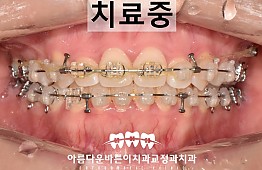 수술후