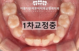 수술후