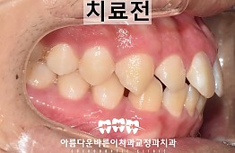 수술전