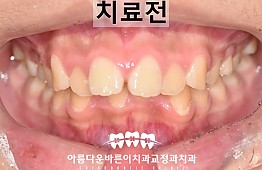 수술전