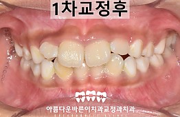 수술후