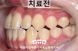 수술전