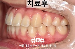 수술후