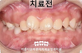 수술전