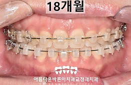 수술후