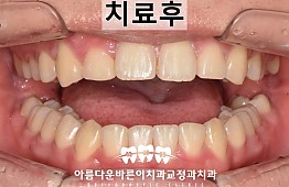 수술후