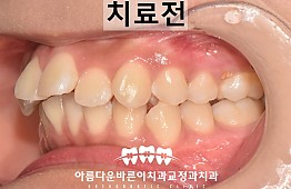 수술전