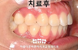 수술후