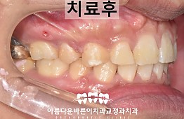 수술후