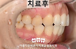 수술후
