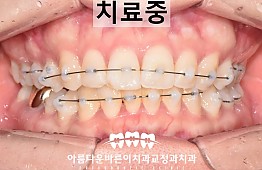 수술후