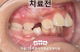수술전