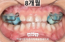 수술후