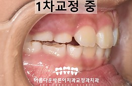 수술후
