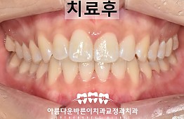 수술후