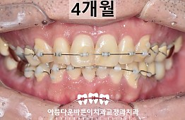 수술후