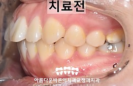 수술전