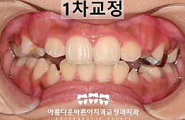 수술후