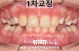 수술후