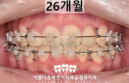 수술후