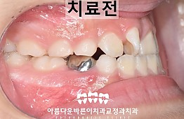 수술전